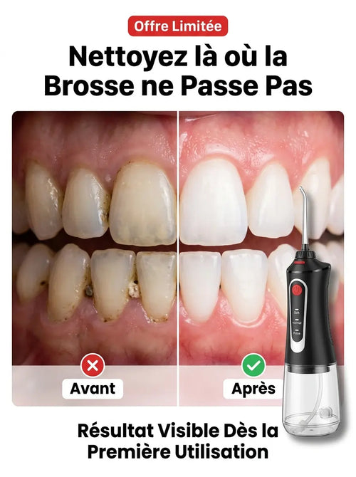 Hydropulseur Oral Portable Rechargeable, Dents et Gencives Impeccables